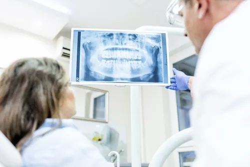 Dental Digital X-Ray available at Mount Vernon Smile Design in Mount Vernon, WA
