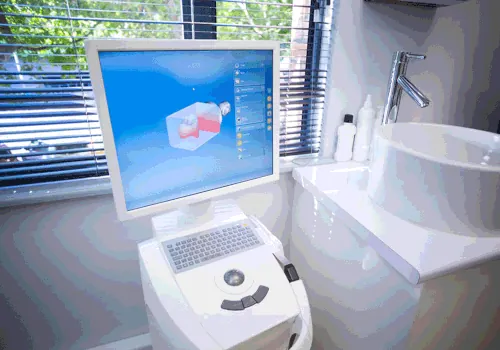 iTero Digital Scanner & Imager available at Mount Vernon Smile Design in Mount Vernon, WA