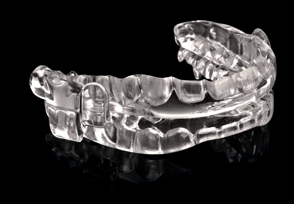 Clear dental appliance, specifically a mandibular advancement device (MAD), used to treat sleep apnea and snoring by positioning the lower jaw slightly forward. Made of transparent plastic with upper and lower trays.