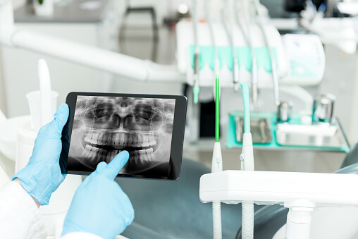 doctor pointing to an xray on an ipad